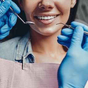 Знижка 1000 грн на офісне відбілювання зубів від стоматологічної клініки «Stomaline» -111785366